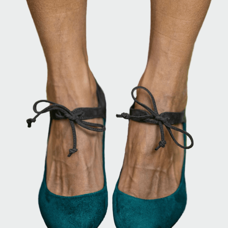 Pahkluu rihmaga kuningad