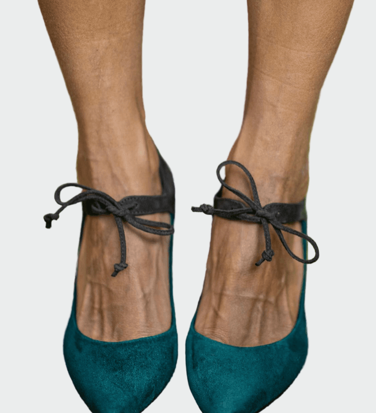 Pahkluu rihmaga kuningad